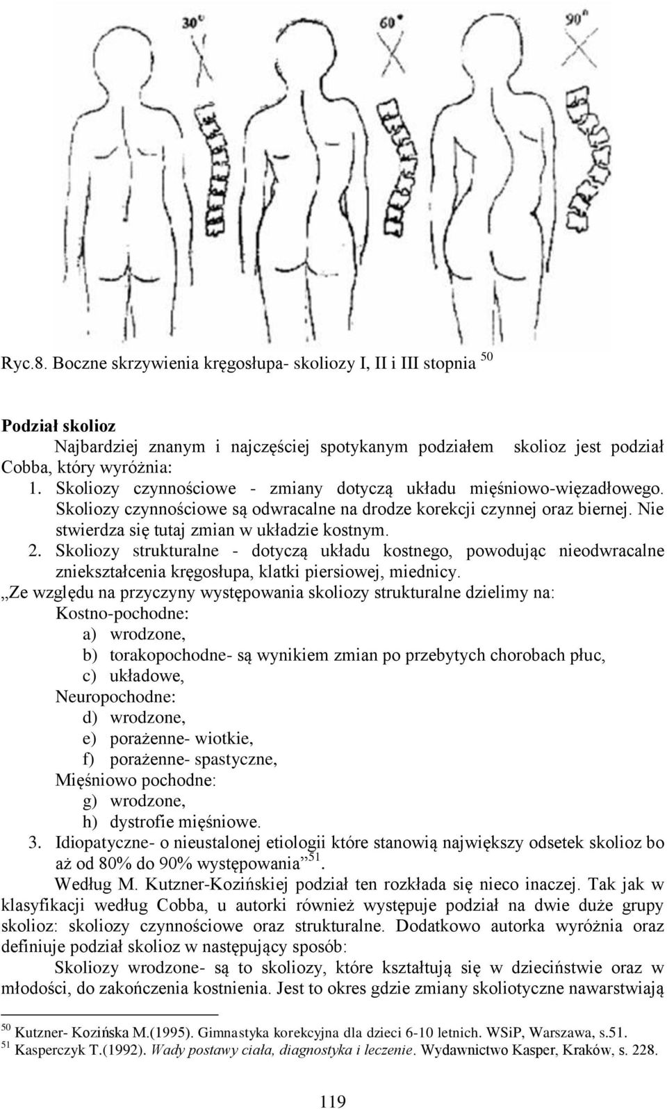 Skoliozy strukturalne - dotyczą układu kostnego, powodując nieodwracalne zniekształcenia kręgosłupa, klatki piersiowej, miednicy.