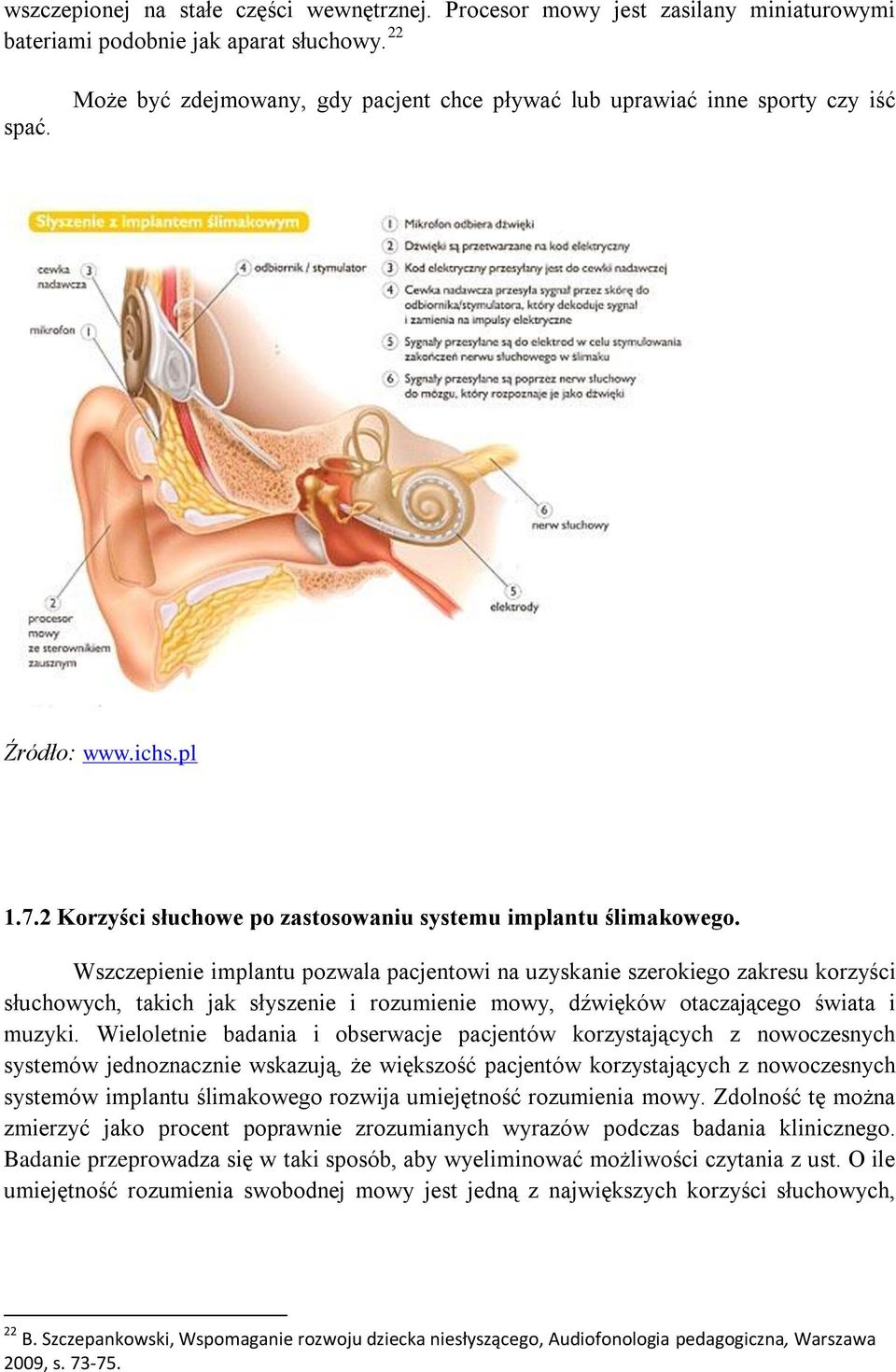 Wszczepienie implantu pozwala pacjentowi na uzyskanie szerokiego zakresu korzyści słuchowych, takich jak słyszenie i rozumienie mowy, dźwięków otaczającego świata i muzyki.