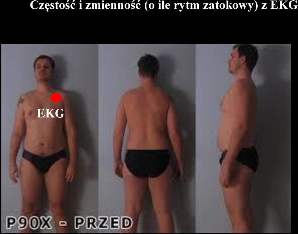 ile rytm