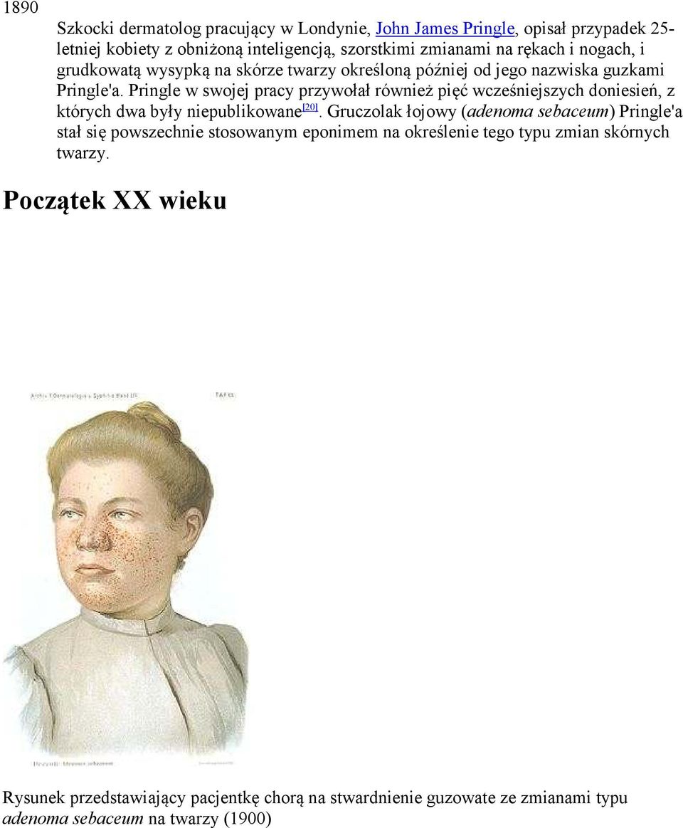 Pringle w swojej pracy przywołał również pięć wcześniejszych doniesień, z których dwa były niepublikowane [20].
