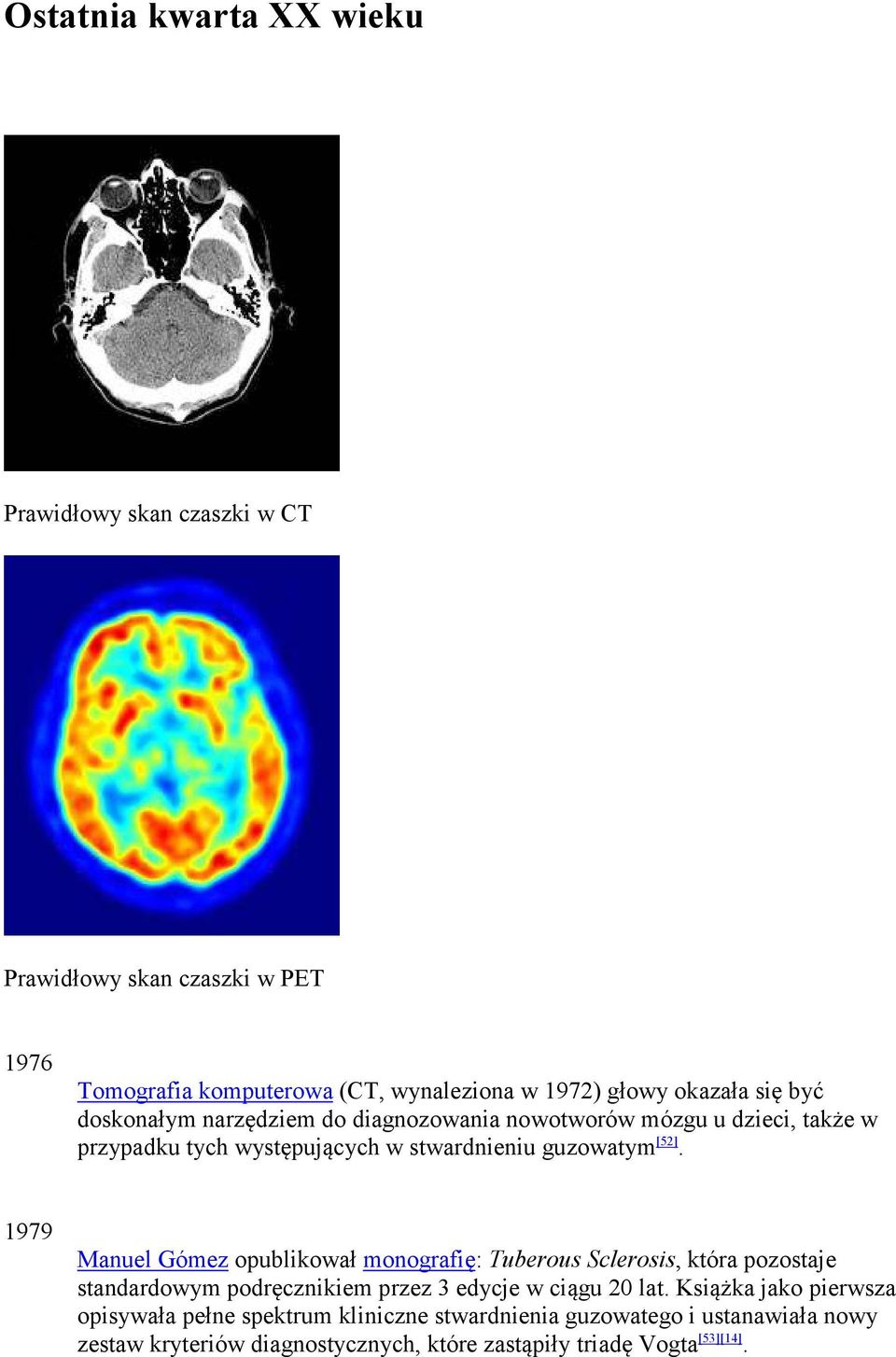 1979 Manuel Gómez opublikował monografię: Tuberous Sclerosis, która pozostaje standardowym podręcznikiem przez 3 edycje w ciągu 20 lat.