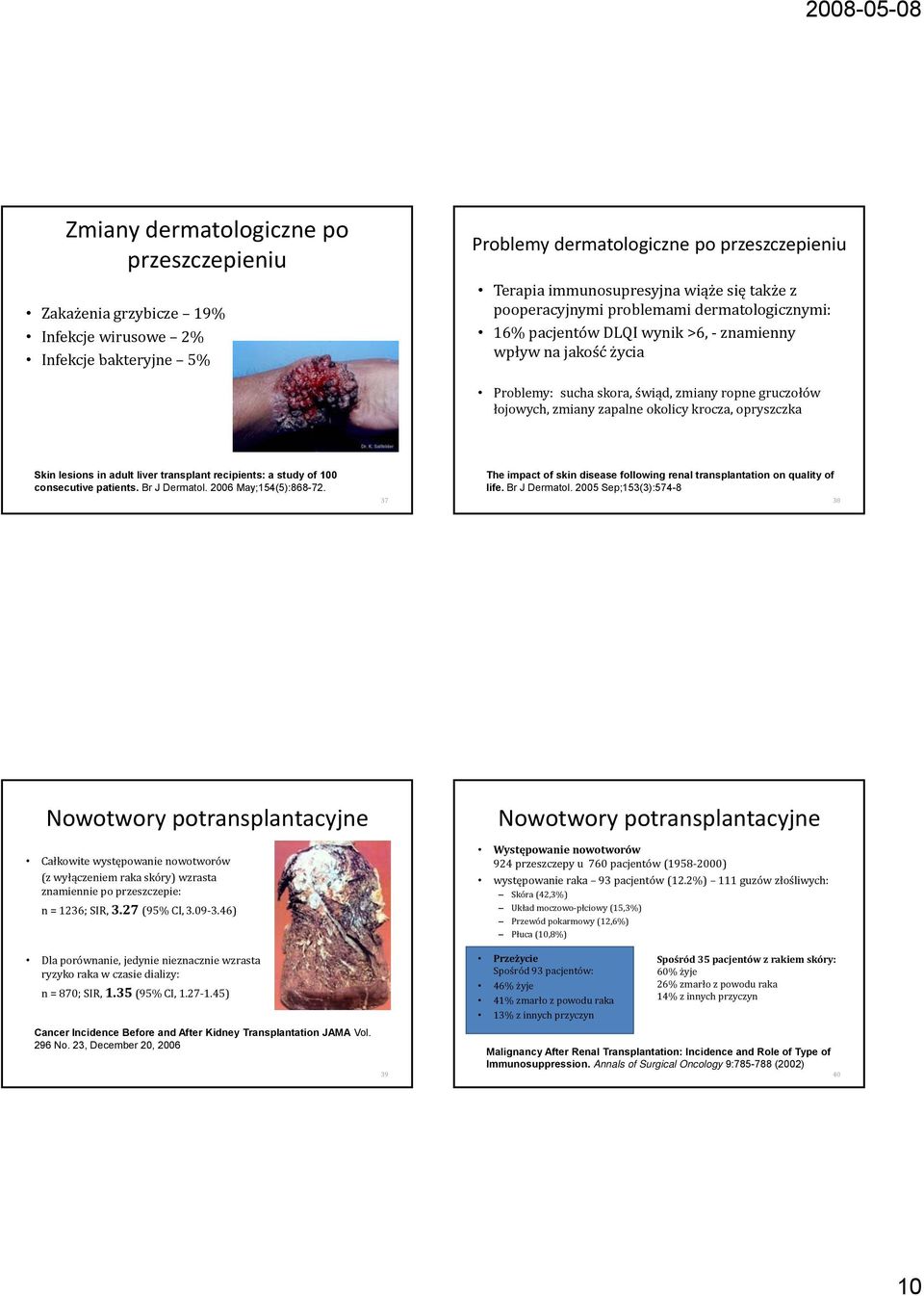 krocza, opryszczka Skin lesions in adult liver transplant recipients: a study of 100 consecutive patients. Br J Dermatol. 2006 May;154(5):868-72.
