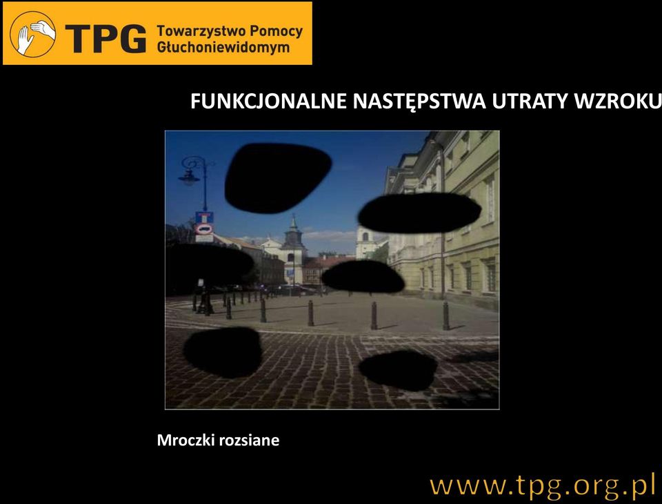 UTRATY WZROKU