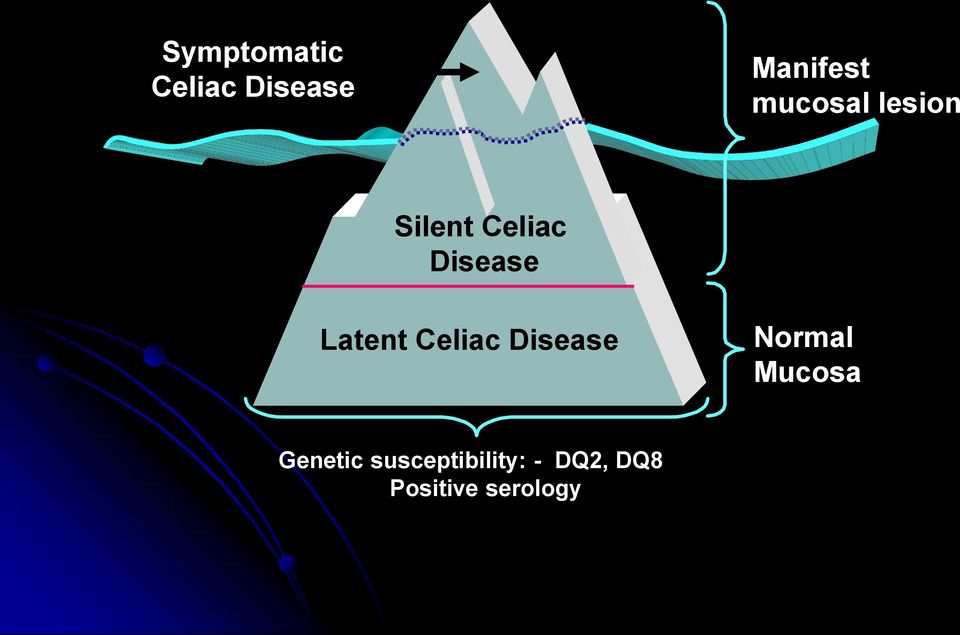 Latent Celiac Disease Normal Mucosa