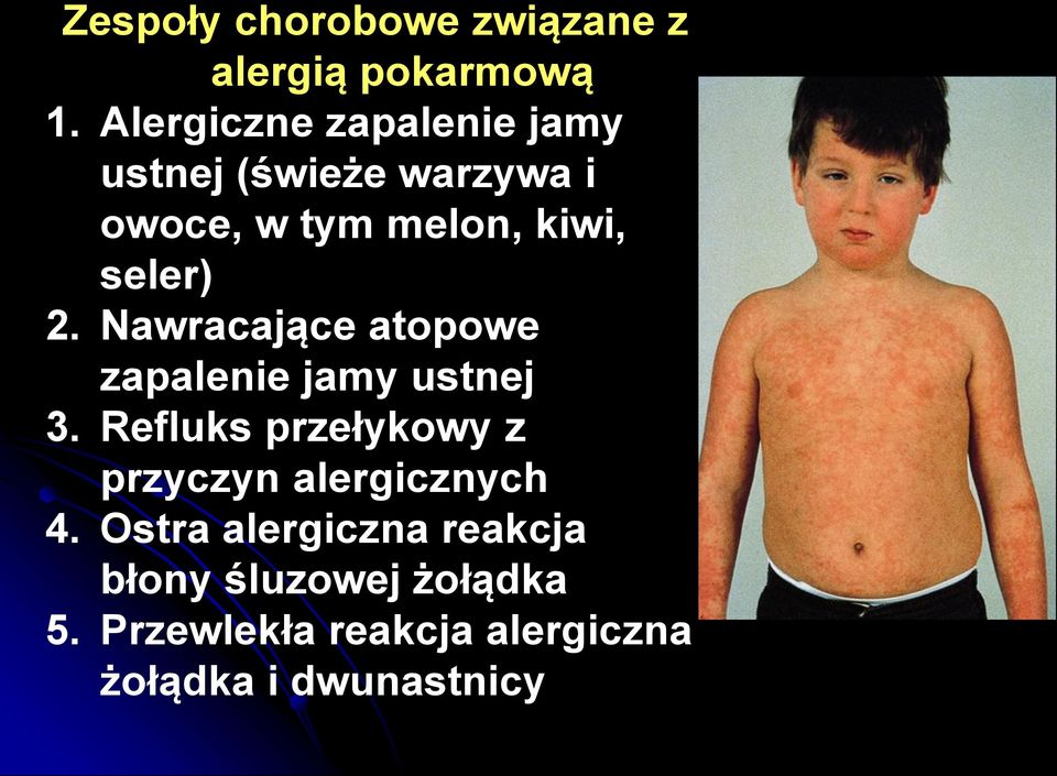 seler) 2. Nawracające atopowe zapalenie jamy ustnej 3.