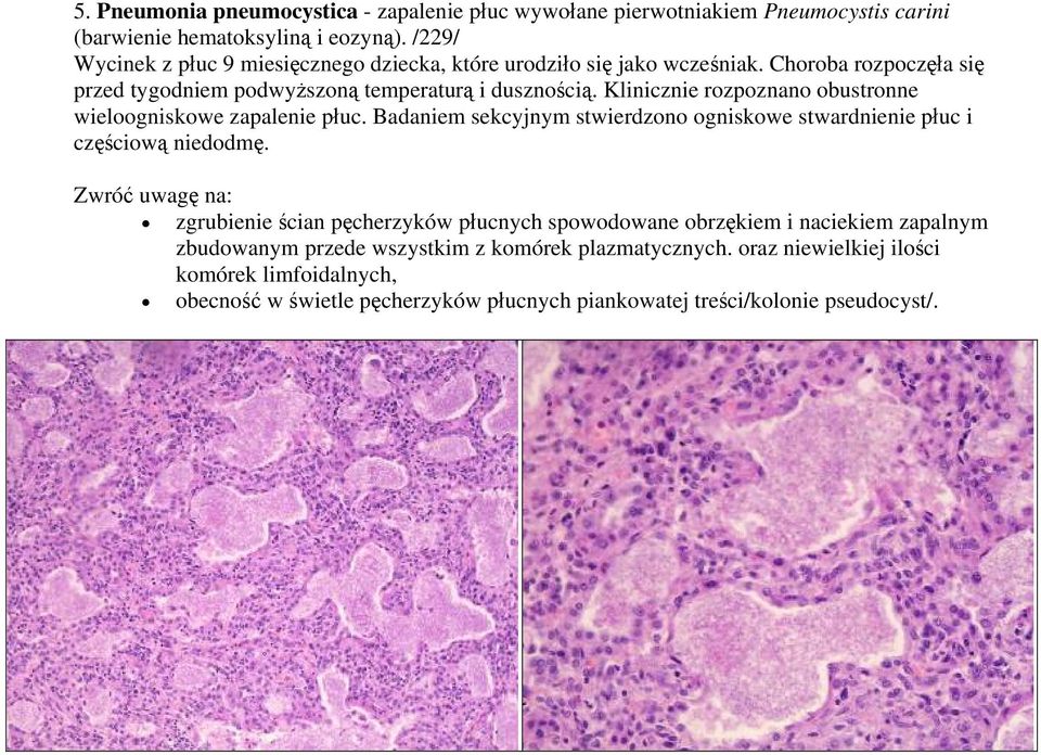Klinicznie rozpoznano obustronne wieloogniskowe zapalenie płuc. Badaniem sekcyjnym stwierdzono ogniskowe stwardnienie płuc i częściową niedodmę.