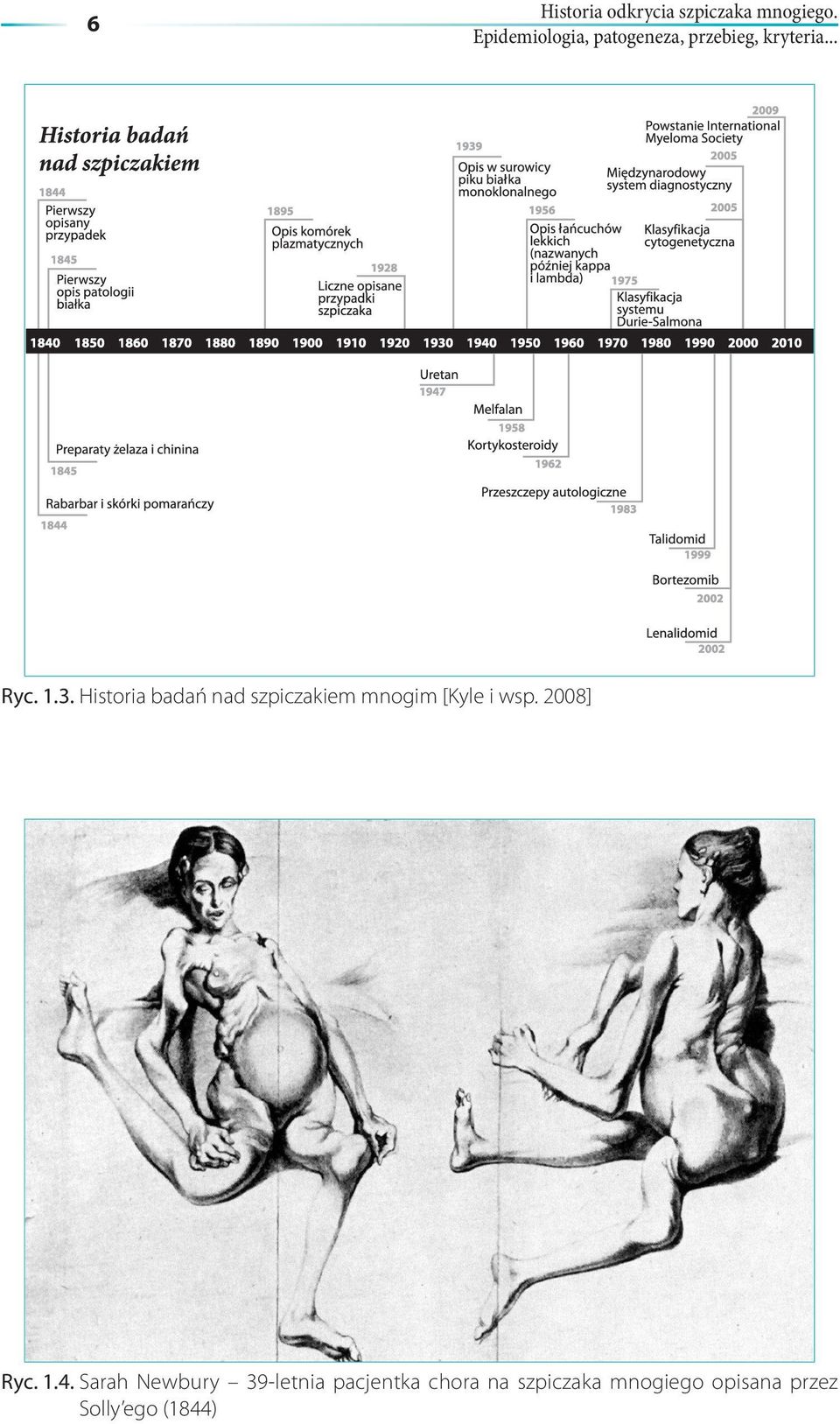 Historia badań nad szpiczakiem mnogim [Kyle i wsp. 2008] Ryc. 1.