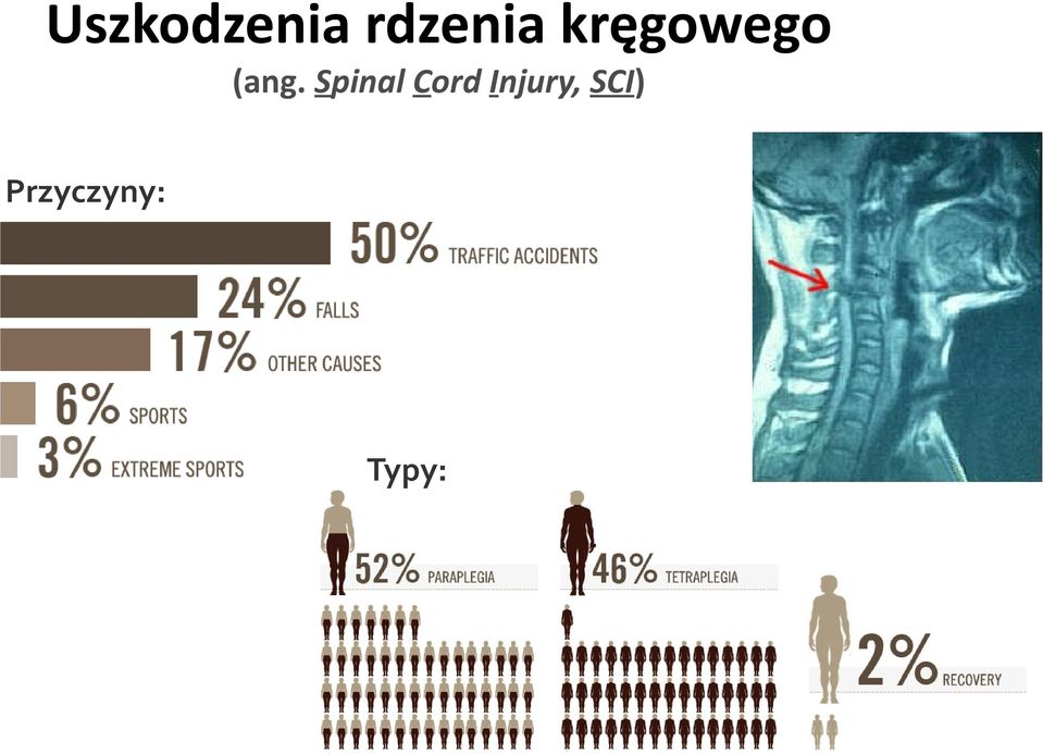 Spinal Cord Injury,