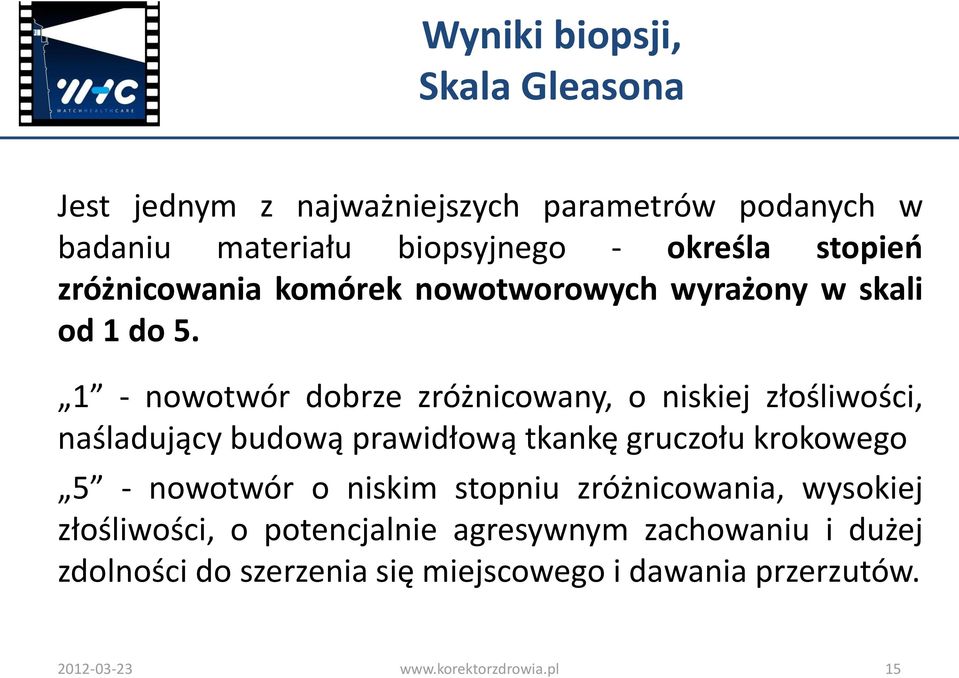 1 - nowotwór dobrze zróżnicowany, o niskiej złośliwości, naśladujący budową prawidłową tkankę gruczołu krokowego 5 - nowotwór o