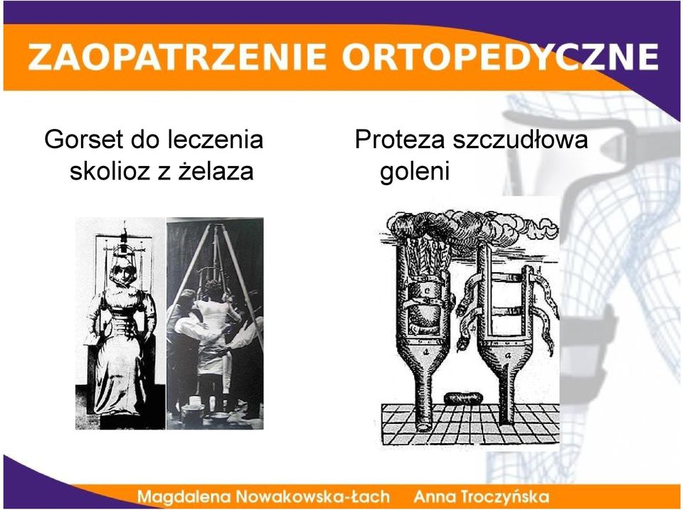 skolioz z