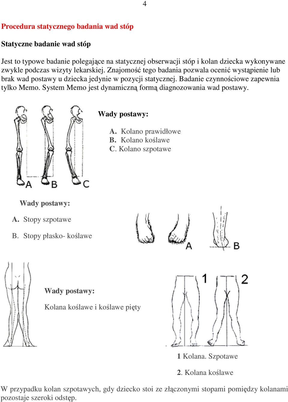 System Memo jest dynamiczną formą diagnozowania wad postawy. Wady postawy: A. Kolano prawidłowe B. Kolano koślawe C. Kolano szpotawe Wady postawy: A. Stopy szpotawe B.
