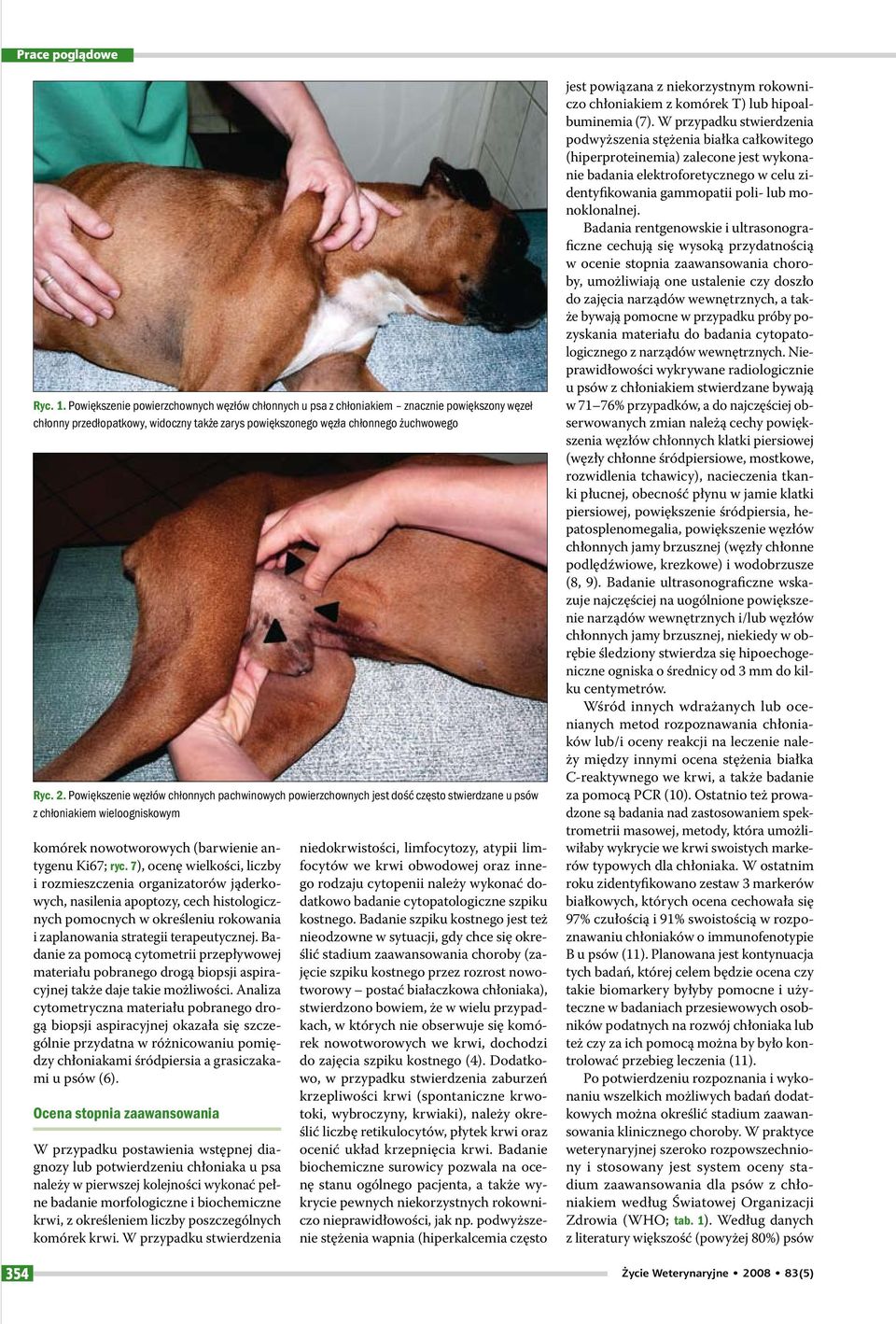 7), ocenę wielkości, liczby i rozmieszczenia organizatorów jąderkowych, nasilenia apoptozy, cech histologicznych pomocnych w określeniu rokowania i zaplanowania strategii terapeutycznej.