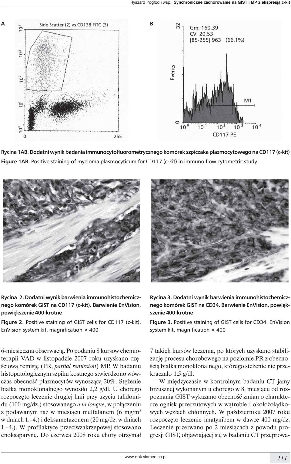 Positive staining of myeloma plasmocyticum for CD117 (c-kit) in immuno flow cytometric study Rycina 2. Dodatni wynik barwienia immunohistochemicznego komórek GIST na CD117 (c-kit).