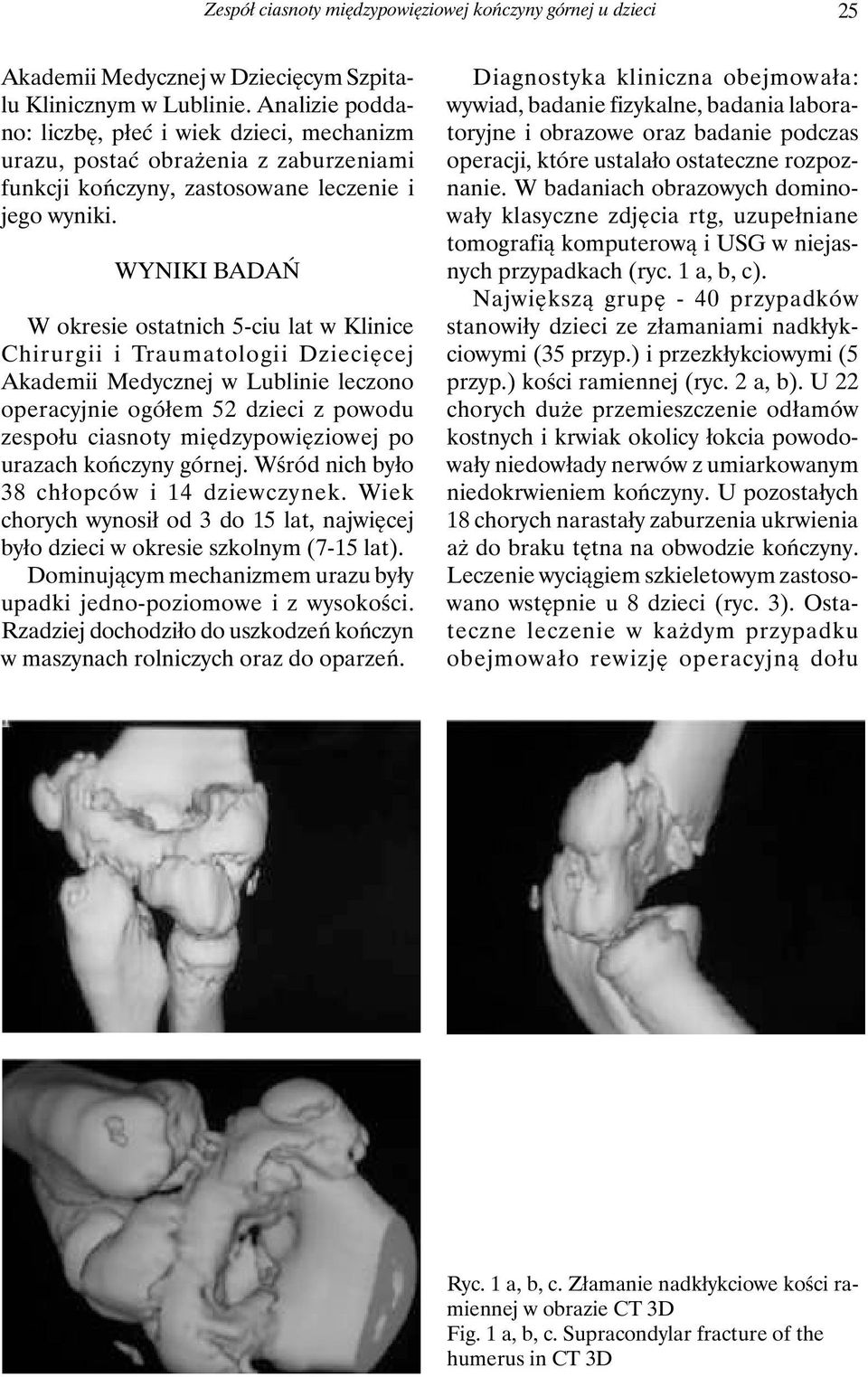 WYNIKI BADAŃ W okresie ostatnich 5-ciu lat w Klinice Chirurgii i Traumatologii Dziecięcej Akademii Medycznej w Lublinie leczono operacyjnie ogółem 52 dzieci z powodu zespołu ciasnoty