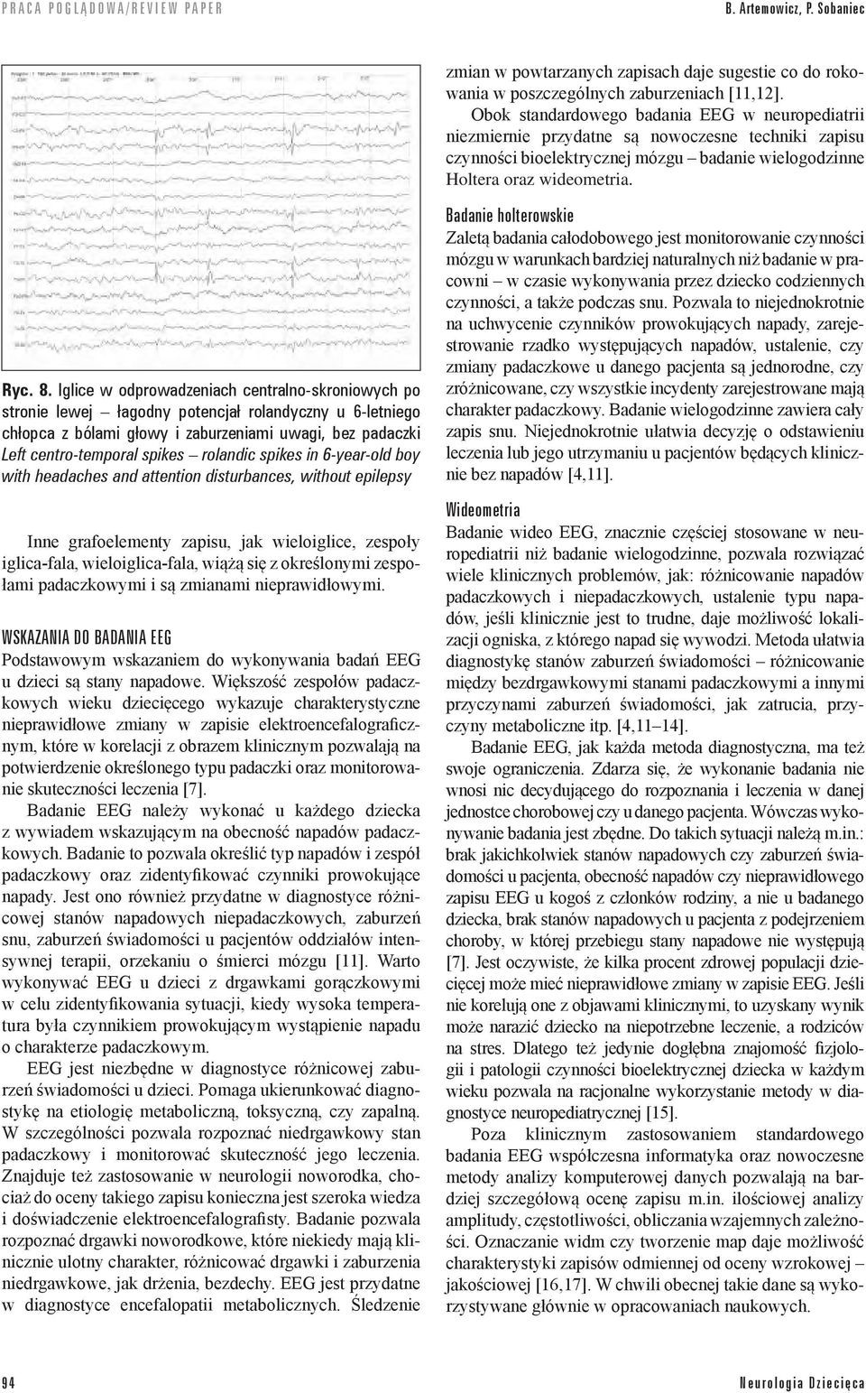 Iglice w odprowadzeniach centralno-skroniowych po stronie lewej łagodny potencjał rolandyczny u 6-letniego chłopca z bólami głowy i zaburzeniami uwagi, bez padaczki Left centro-temporal spikes