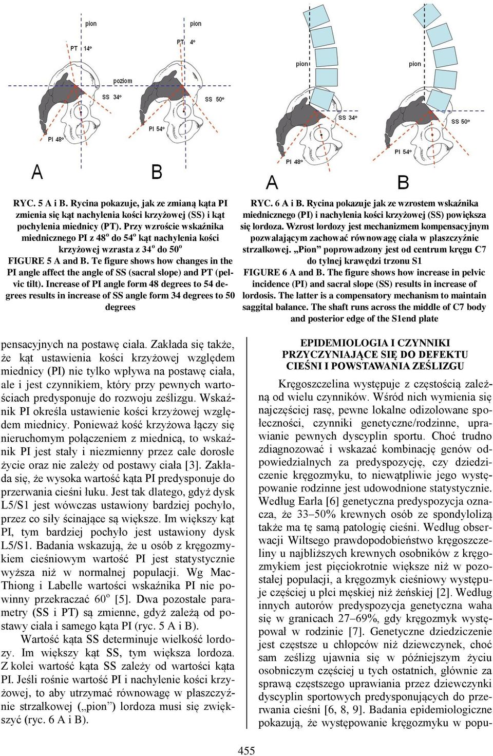 Te figure shows how changes in the PI angle affect the angle of SS (sacral slope) and PT (pelvic tilt).