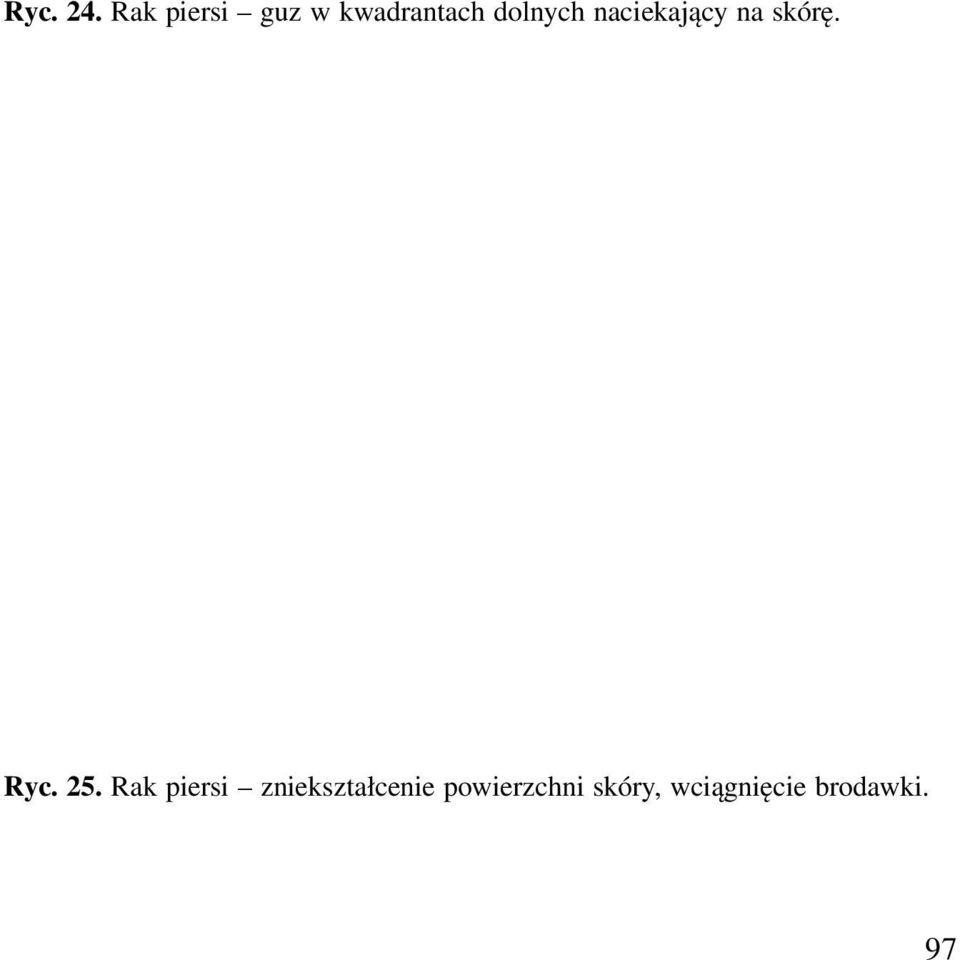 naciekający na skórę. Ryc. 25.