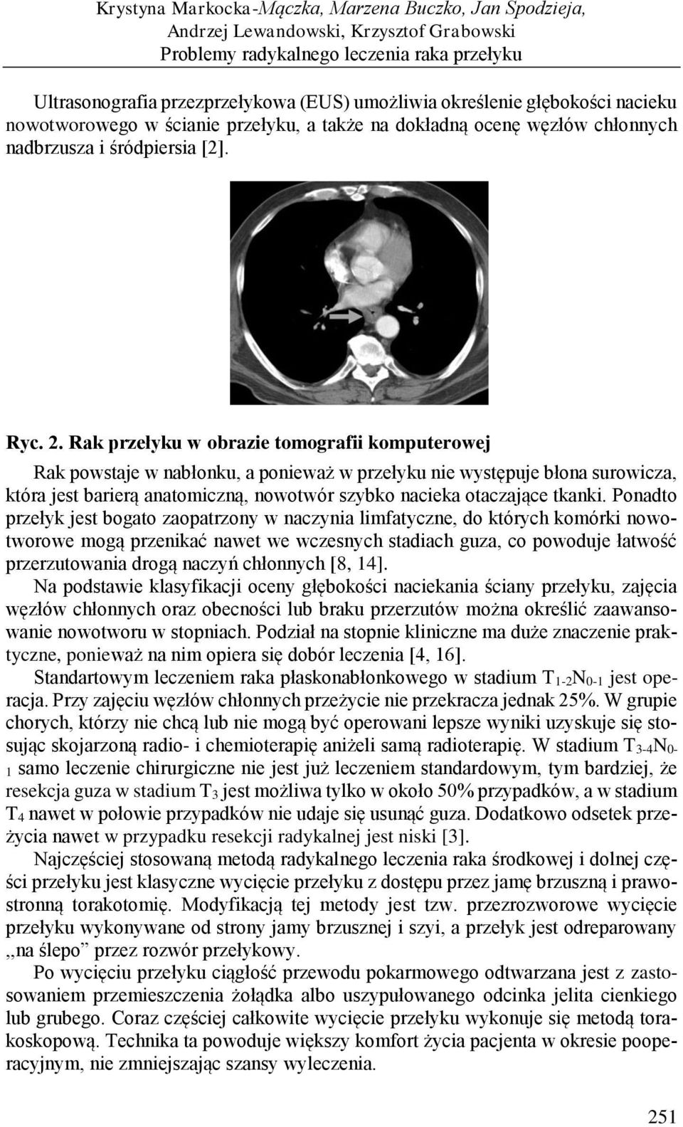 Rak przełyku w obrazie tomografii komputerowej Rak powstaje w nabłonku, a ponieważ w przełyku nie występuje błona surowicza, która jest barierą anatomiczną, nowotwór szybko nacieka otaczające tkanki.