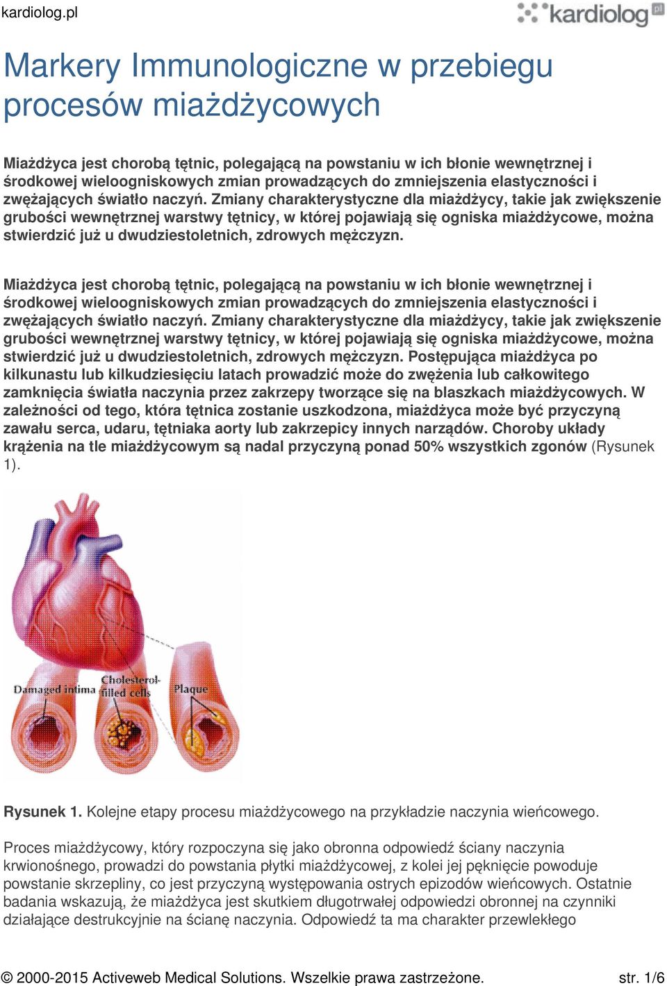 Zmiany charakterystyczne dla miażdżycy, takie jak zwiększenie grubości wewnętrznej warstwy tętnicy, w której pojawiają się ogniska miażdżycowe, można stwierdzić już u dwudziestoletnich, zdrowych