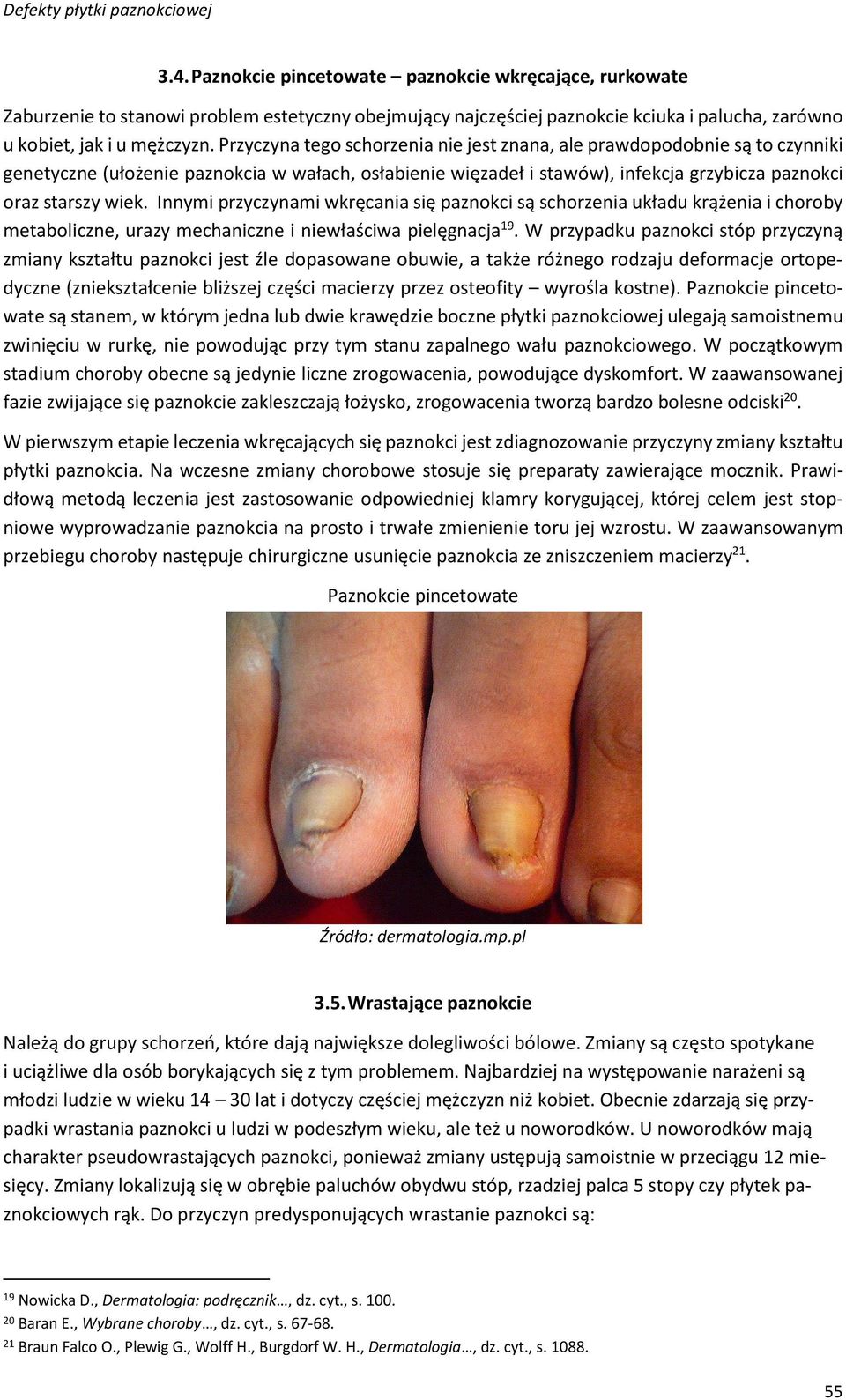 Innymi przyczynami wkręcania się paznokci są schorzenia układu krążenia i choroby metaboliczne, urazy mechaniczne i niewłaściwa pielęgnacja 19.