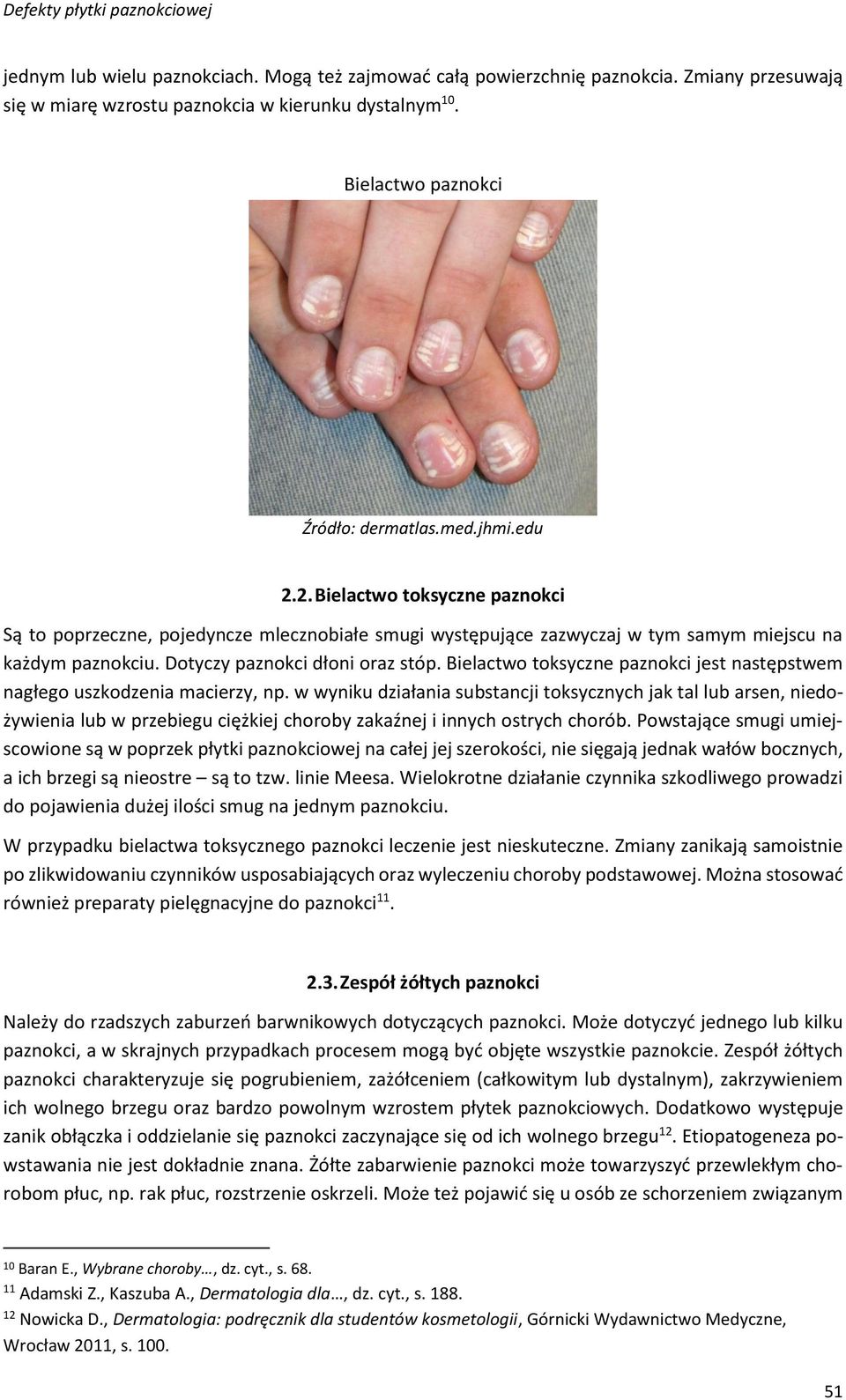 Bielactwo toksyczne paznokci jest następstwem nagłego uszkodzenia macierzy, np.