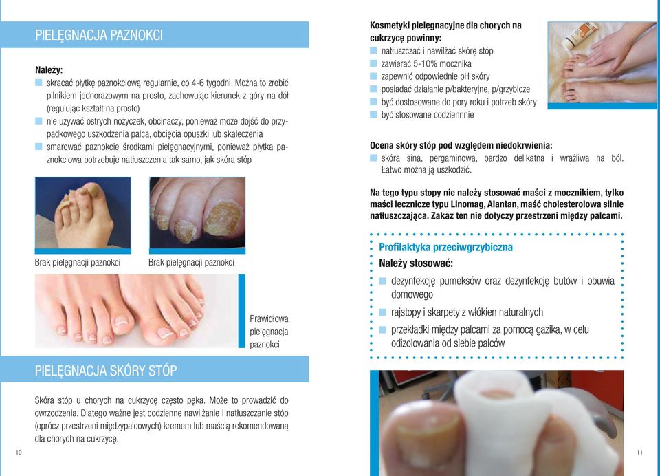uszkodzenia palca, obcięcia opuszki lub skaleczenia smarować paznokcie środkami pielęgnacyjnymi, ponieważ płytka paznokciowa potrzebuje natłuszczenia tak samo, jak skóra stóp Kosmetyki pielęgnacyjne