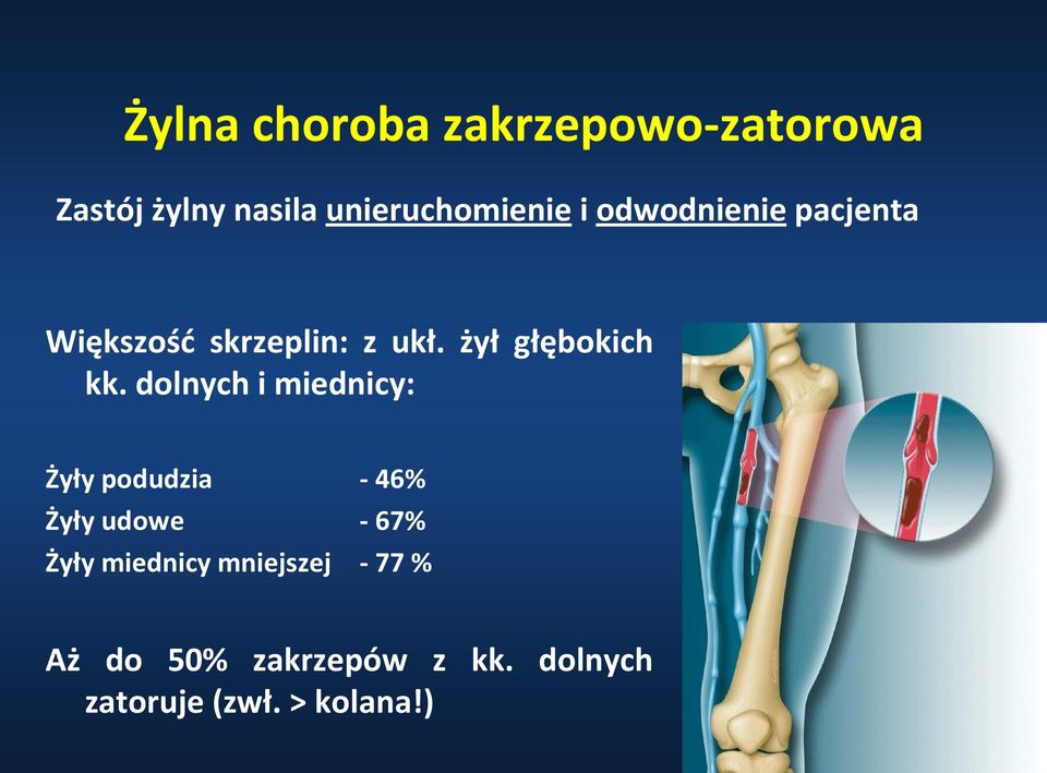 dolnych i miednicy: Żyły podudzia - 46% Żyły udowe - 67% Żyły miednicy