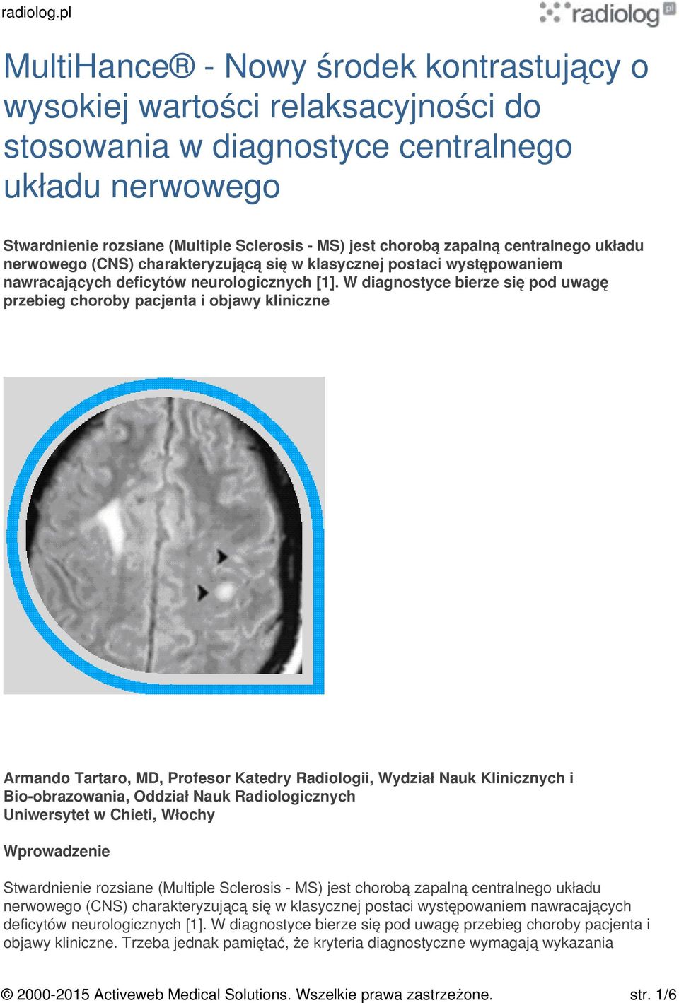 W diagnostyce bierze się pod uwagę przebieg choroby pacjenta i objawy kliniczne Armando Tartaro, MD, Profesor Katedry Radiologii, Wydział Nauk Klinicznych i Bio-obrazowania, Oddział Nauk