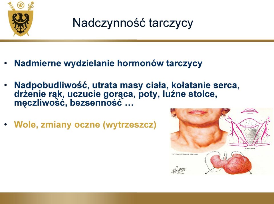 serca, drżenie rąk, uczucie gorąca, poty, luźne
