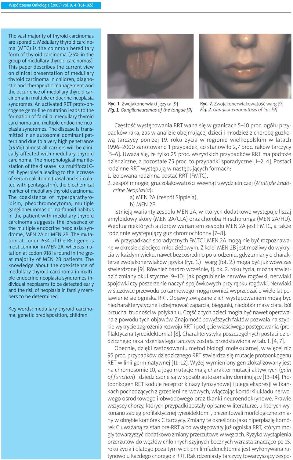 This paper describes the current view on clinical presentation of medullary thyroid carcinoma in children, diagnostic and therapeutic management and the occurrence of medullary thyroid carcinoma in