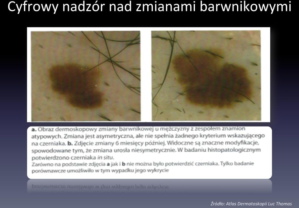 barwnikowymi