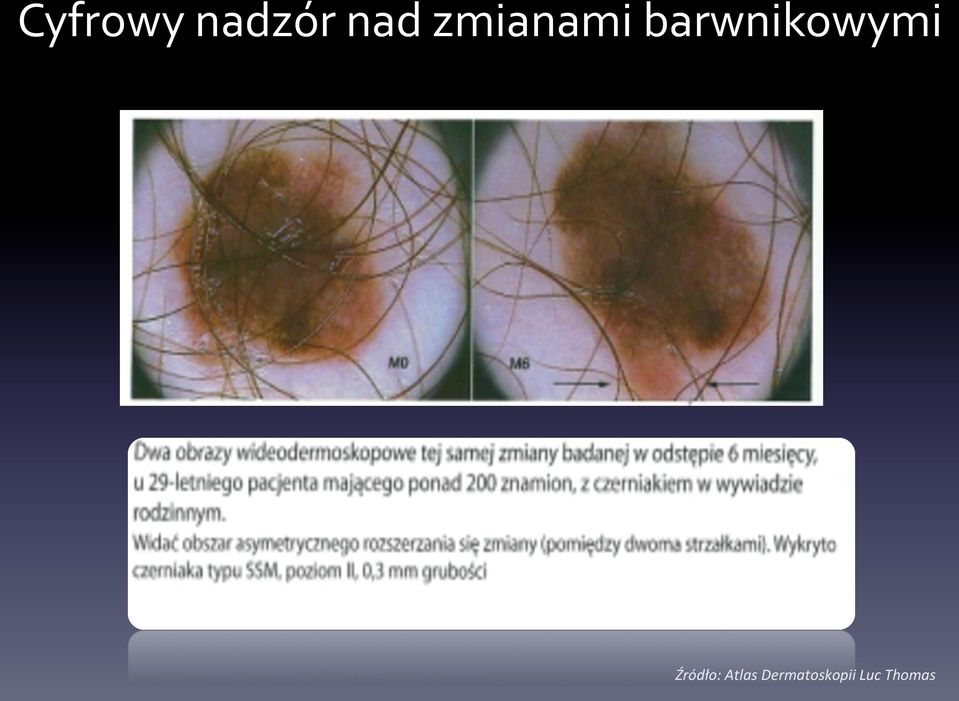 barwnikowymi