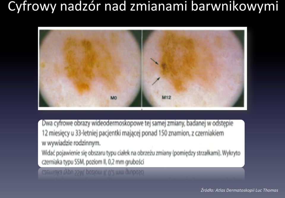 barwnikowymi