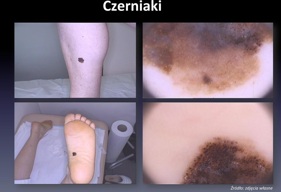 zdjęcia
