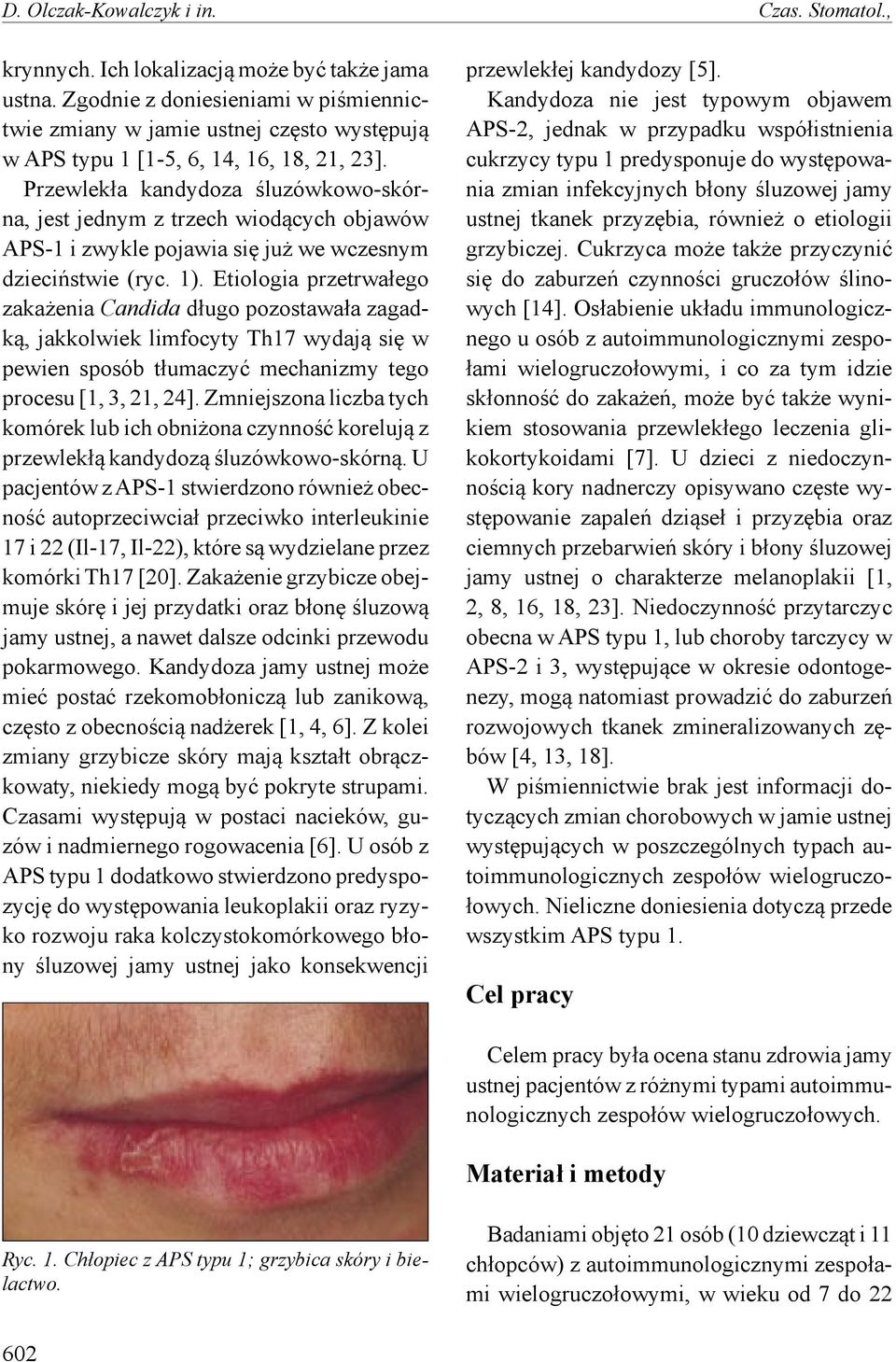 Przewlekła kandydoza śluzówkowo-skórna, jest jednym z trzech wiodących objawów APS-1 i zwykle pojawia się już we wczesnym dzieciństwie (ryc. 1).