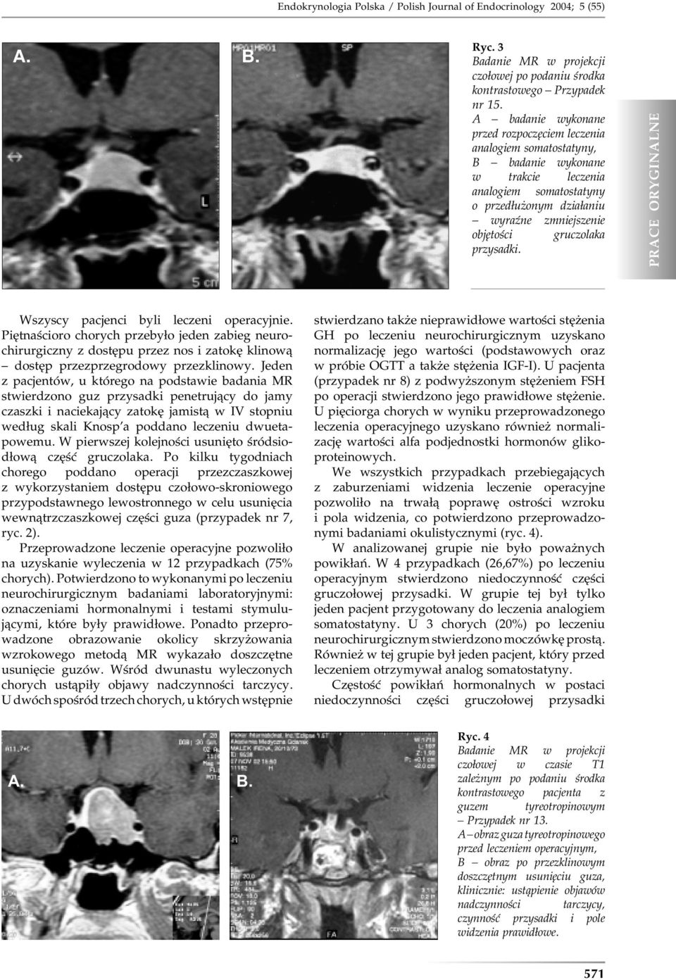 gruczolaka przysadki. Wszyscy pacjenci byli leczeni operacyjnie. Piętnaścioro chorych przebyło jeden zabieg neurochirurgiczny z dostępu przez nos i zatokę klinową dostęp przezprzegrodowy przezklinowy.