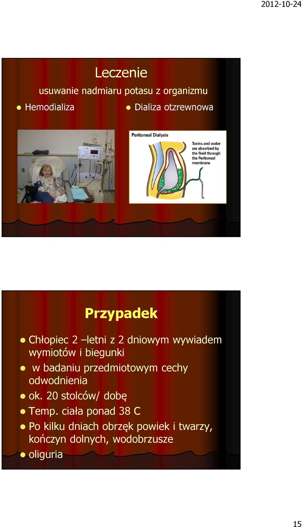 przedmiotowym cechy odwodnienia ok. 20 stolców/ dobę Temp.