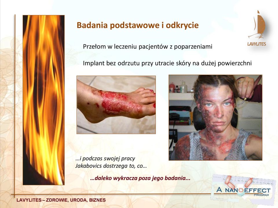 utracie skóry na dużej powierzchni i podczas swojej