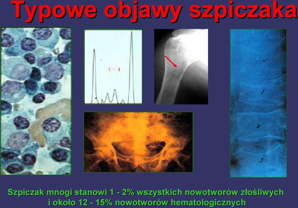 wszystkich nowotworów