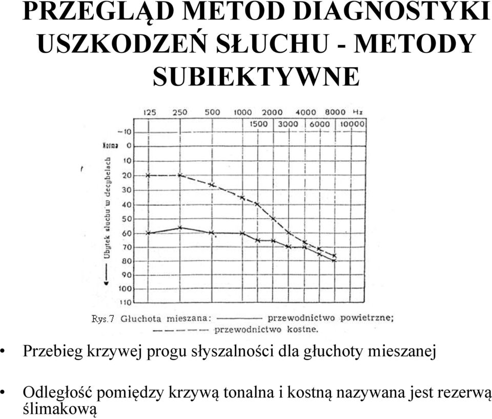 słyszalności dla głuchoty mieszanej Odległość