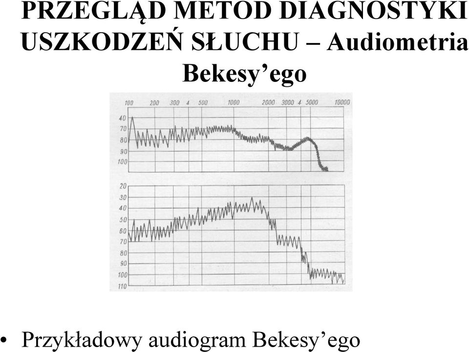 SŁUCHU Audiometria Bekesy