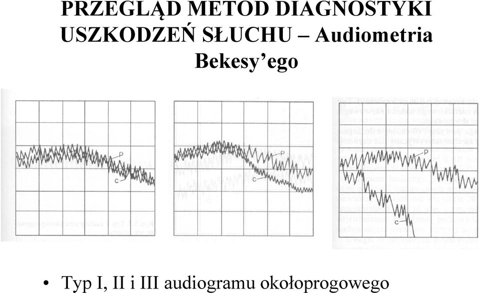 Bekesy ego ego Typ I, II i