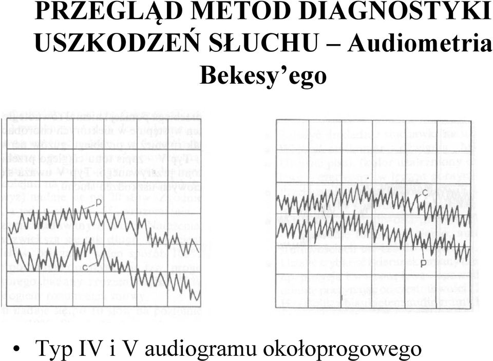 SŁUCHU Audiometria Bekesy