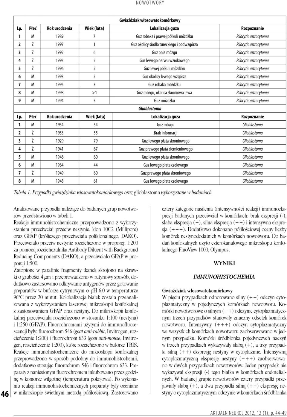 astrocytoma 3 Ż 1992 6 Guz pnia mózgu Pilocytic astrocytoma 4 Ż 1993 5 Guz lewego nerwu wzrokowego Pilocytic astrocytoma 5 Ż 1996 2 Guz lewej półkuli móżdżku Pilocytic astrocytoma 6 M 1993 5 Guz