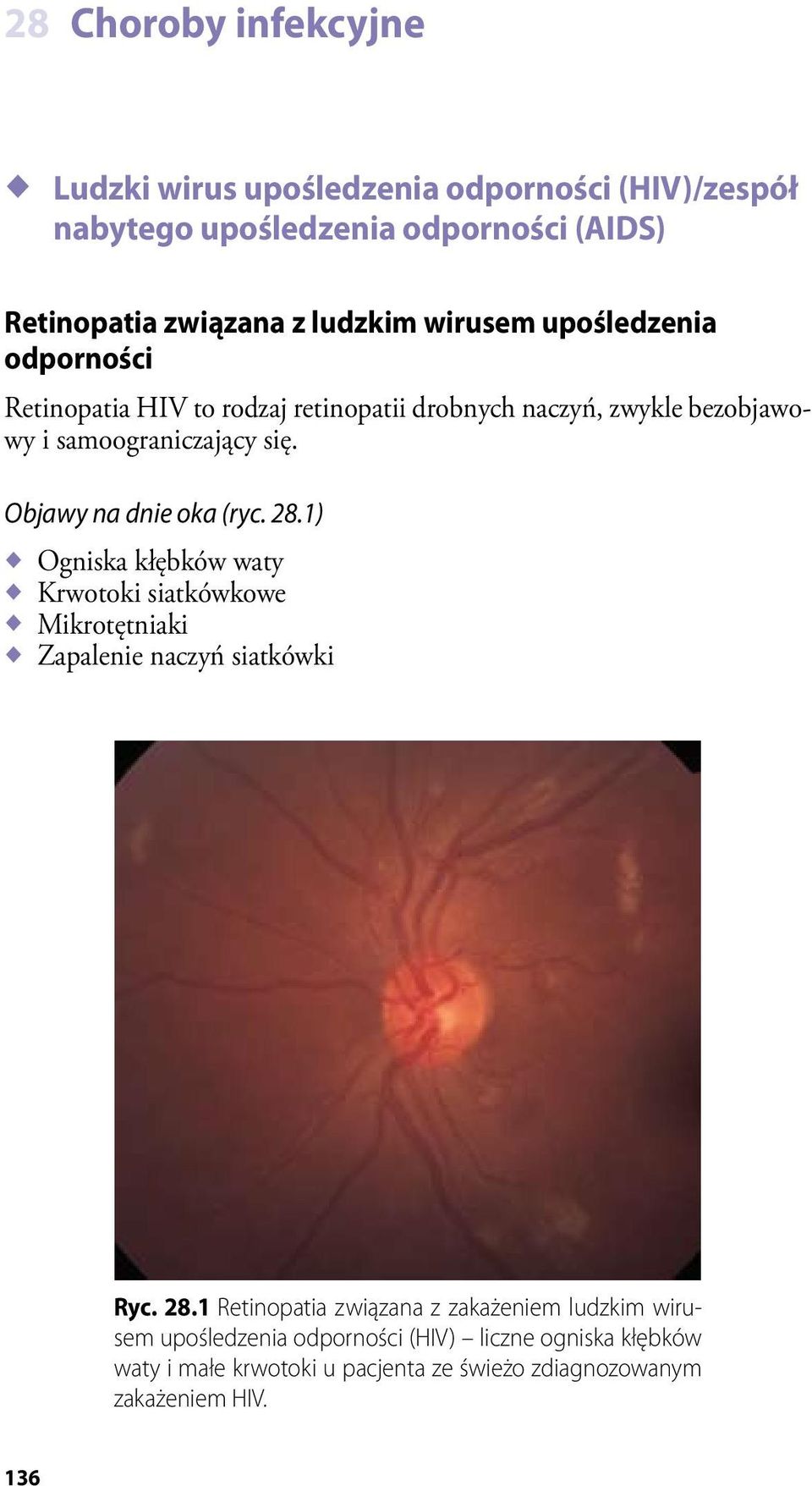 Objawy na dnie oka (ryc. 28.