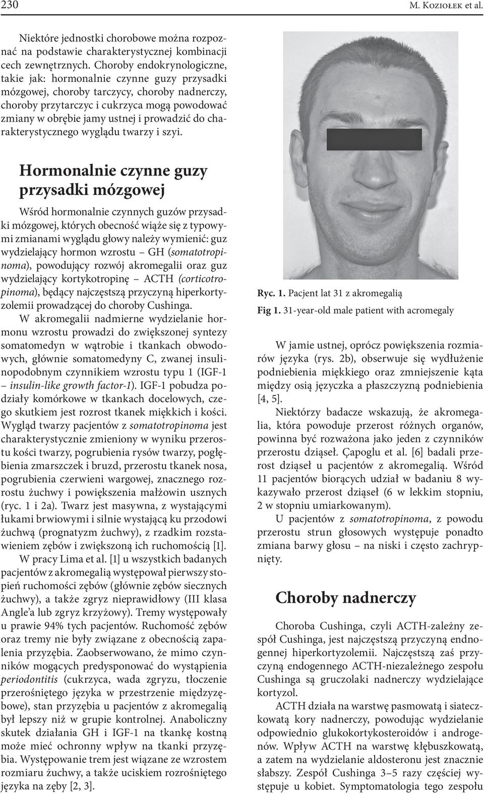 Objawy Chorób Endokrynologicznych U Pacjentów Leczonych