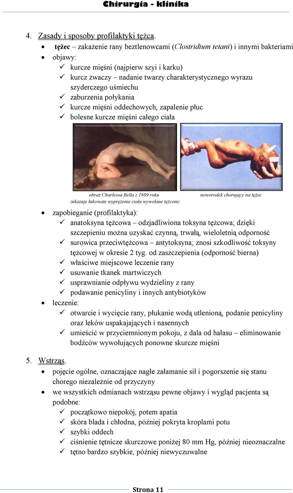 zaburzenia połykania kurcze mięśni oddechowych, zapalenie płuc bolesne kurcze mięśni całego ciała obraz Charlessa Bella z 1809 roku (ukazuje łukowate wyprężenie ciała wywołane tężcem) noworodek