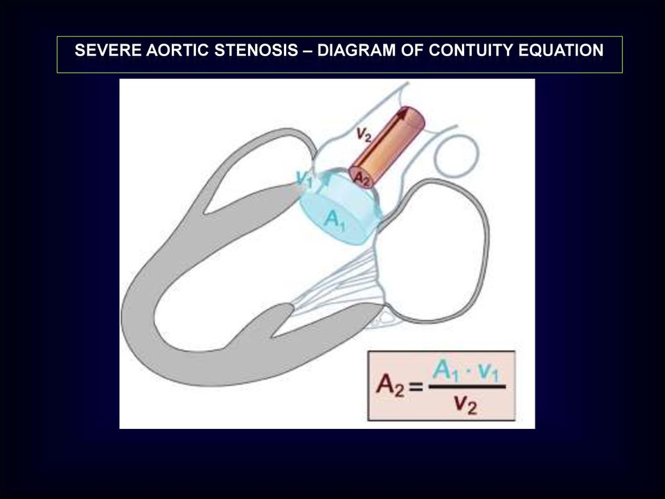 STENOSIS