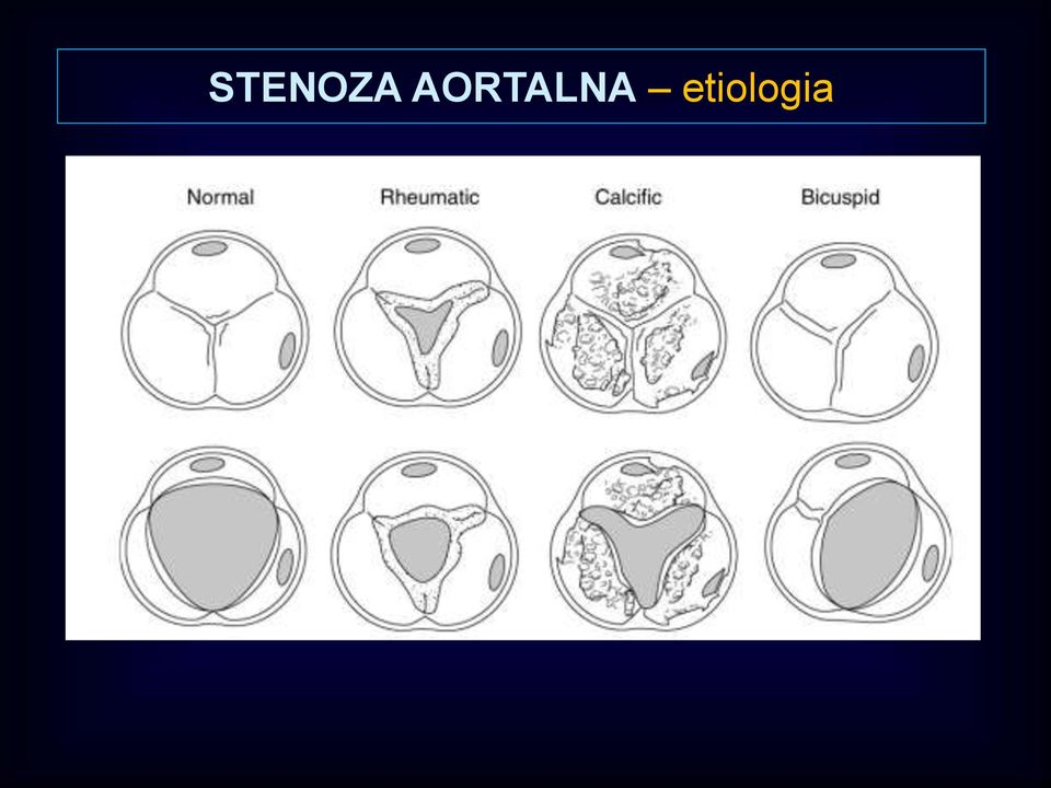 etiologia