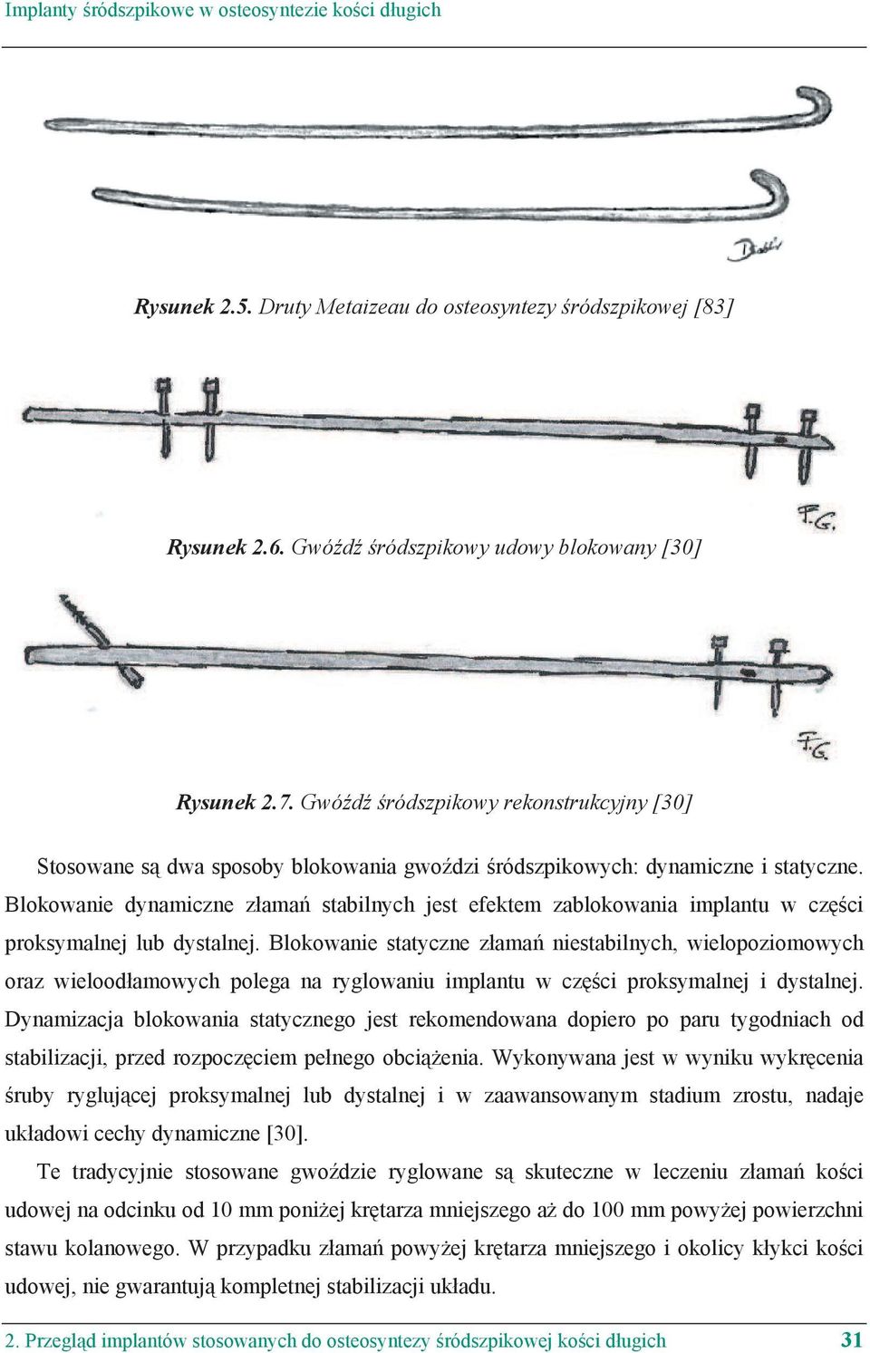 Blokowanie dynamiczne z ama stabilnych jest efektem zablokowania implantu w cz ci proksymalnej lub dystalnej.